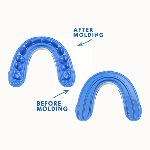 VitalSleep Adjustable Anti Snoring Mouthpiece  FDA Cleared, USA Made